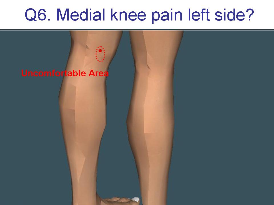 A6 Medial Knee Pain Left Side Lord Love Health